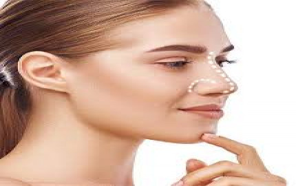 How Safe Is Rhinoplasty Surgery?