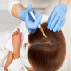 Top PRP Hair Restoration Services in Dubai