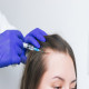 What Are the Advantages of GFC Treatment for Hair in Dubai?