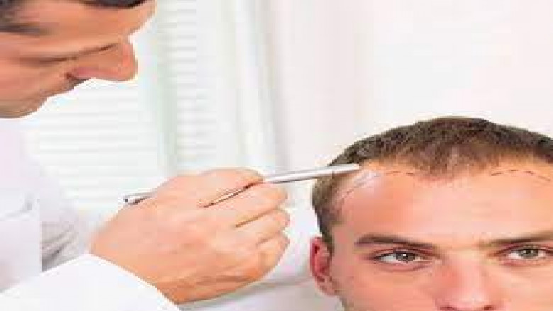 "The Evolution of Hair Transplantation Techniques: Innovations in Islamabad"