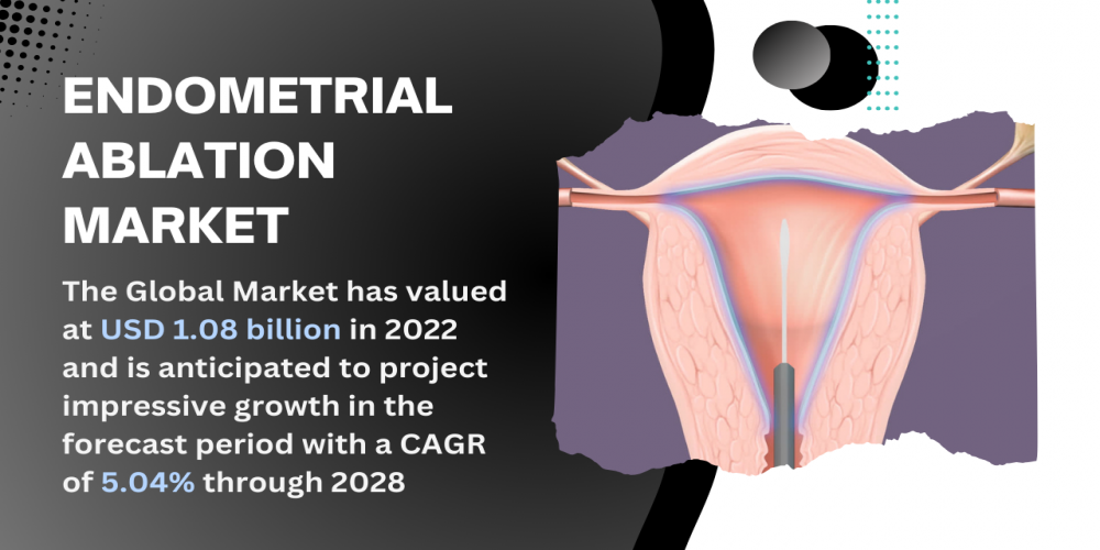 Endometrial Ablation Market [2028]: Key Trends, with Size, Share, and Growth Analysis - TechSci Research