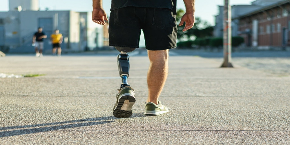 Global Prosthetic Foot  Market Report 2023 to 2032