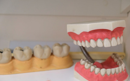 Complete Guide to Dentures: Options and Care in Middlesbrough