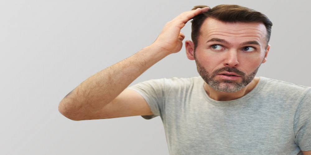 Who Can Benefit from Direct Hair Implant in Dubai?