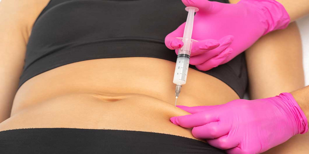 How to Prepare for Fat Injections in Dubai