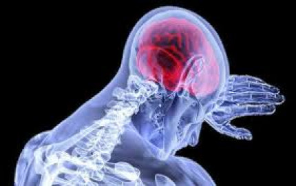 Anaplastic Astrocytoma Market 2023 | Industry Demand, Fastest Growth, Opportunities Analysis and Forecast To 2032
