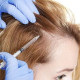 Cost Transparency | Understanding PRP Hair Treatment Pricing