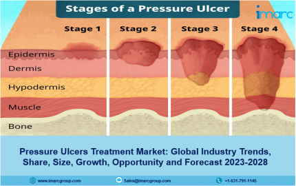 Pressure Ulcers Treatment Market 2023, Size, Demand, Growth, Scope And Forecast 2028