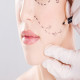 A New Chapter in Beauty: The Facelift Transformation