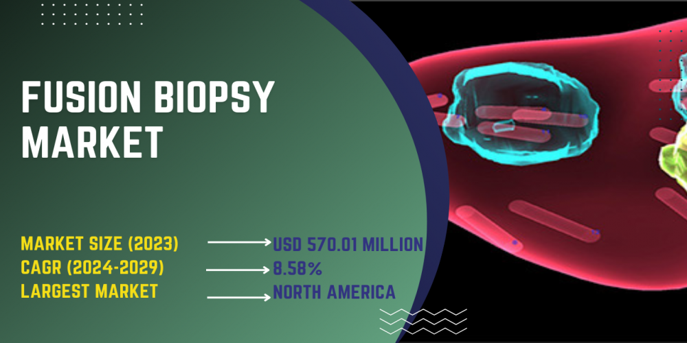 Fusion Biopsy Market: Trends, Competition, and Opportunity Analysis from 2018 to 2029 - Rapid Growth Insights - TechSci Research
