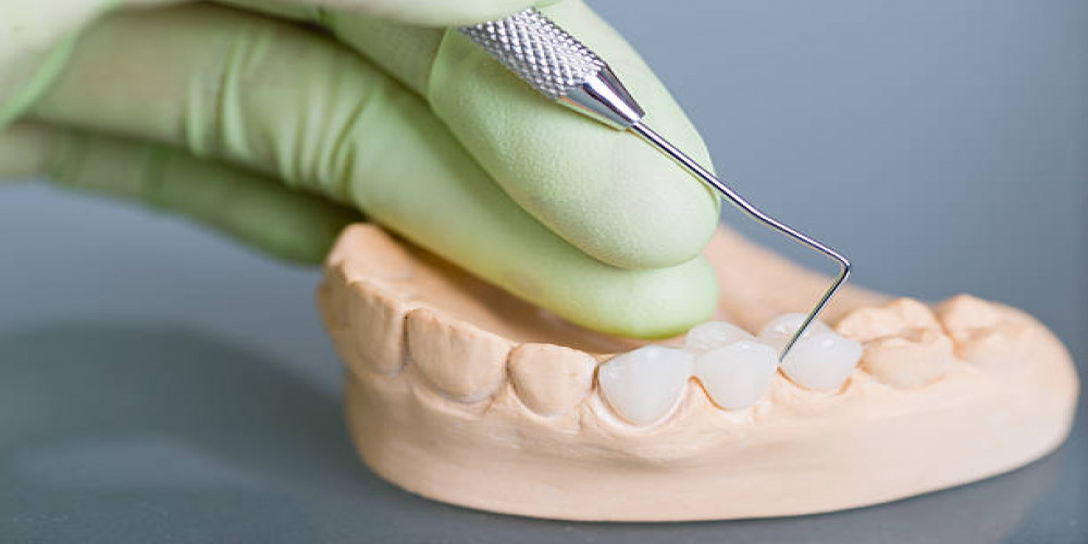 Choosing the Right Dental Crown or Bridge for Your Needs