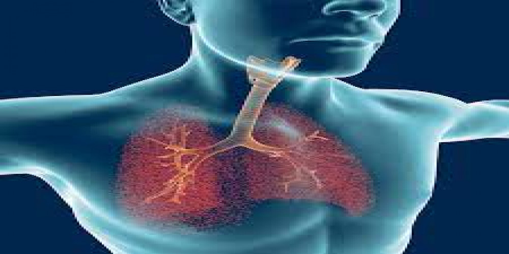Size and Share of Non-Cystic Fibrosis Bronchiectasis (NCFB) Market by 2034