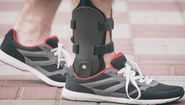 Orthopedic Braces and Supports Market Size, Share, Industry Analysis, Trends, Forecast 2024-2032