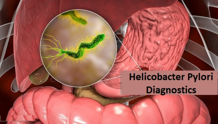 Helicobacter Pylori Diagnostics Market Size, Status, Growth | Industry Analysis Report 2023-2032