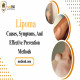Lipoma Causes Symptoms and Treatment