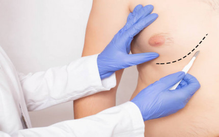  The Riyadh Advantage: Gynecomastia Surgery for You