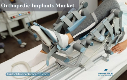 Orthopedic Implants Market : Trends, Innovations, and Growth