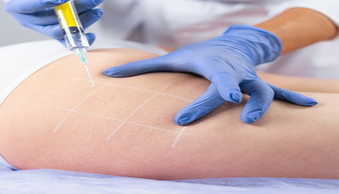 Ditch the Diet, Embrace Results: Fat Melting Injections in Dubai
