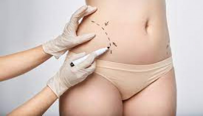 Skip the Downtime: Fat Reduction with Injections in Dubai
