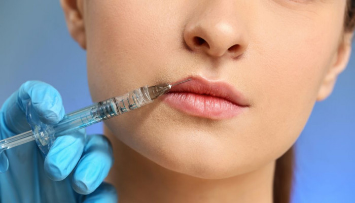 Enhance Your Upper Lip: The Power of a Botox Lip Flip in Dubai