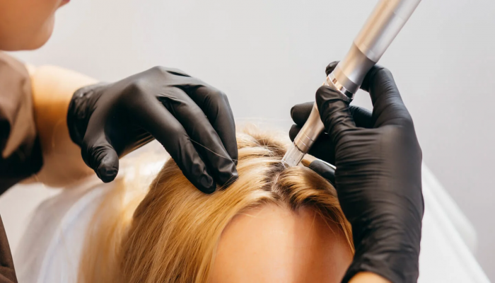 Dubai's Top PRP Hair Restoration Specialists.