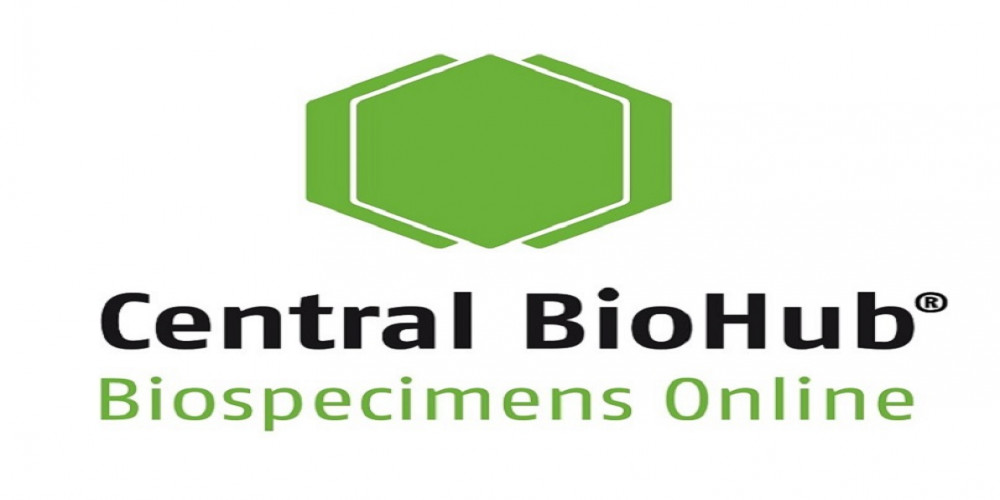 Central BioHub’s Role in Advancing Glaucoma and Cataract Studies through Aqueous Humor Samples
