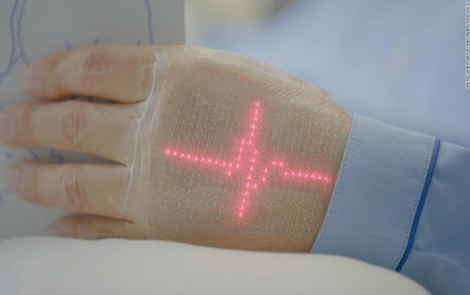 Electronic Skin Market Trends, Growth, and Research Report 2024-2032