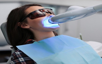 Radiant Smiles: Laser Teeth Whitening Treatment in Islamabad