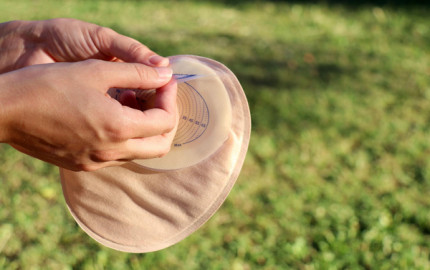 Simplifying Ostomy Care: Breaking Down Common Myths and Misconceptions