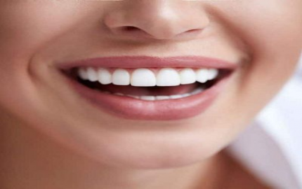 A Radiant Smile Awaits: Exploring Teeth Whitening Options in Dubai