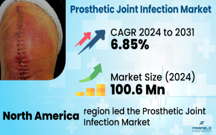 Prosthetic Joint Infection Treatment Market Size, Share, Demand And Top Growing Companies 2030