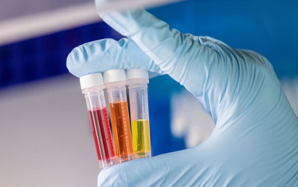 Saudi Arabia In-Vitro Diagnostics (IVD) Market Trends 2024, Industry Growth, Forecast Report By 2032