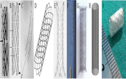 Global Intracranial Stents Market Report 2023 to 2032