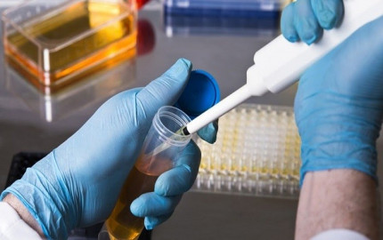 Pharmaceutical Sterility Testing Market: Unveiling Competition, Size, and Robust Growth Prospects Through 2028 - TechSci Research Analysis