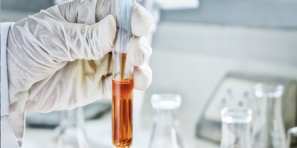 Crude Oil Assay Testing Services Market | Global Industry Growth, Trends, and Forecast 2023 - 2032