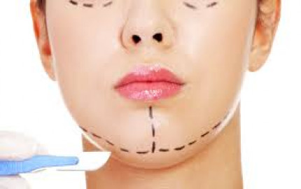Restore Youthful Contours: Vector Facelift Treatment in Riyadh