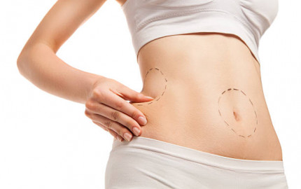 Rediscover Confidence: Abdominal Liposuction Experts in Riyadh