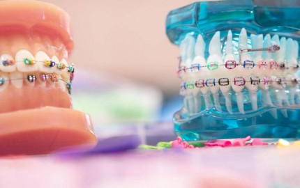 Dentofacial Orthodontics: Crafting Confident Smiles