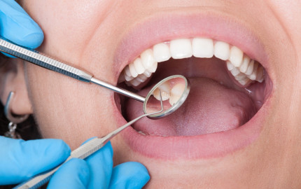 Everything You Need to Know About Dental Extractions in Dubai