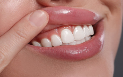 Smile Perfect: Understanding Gum Contouring in Dubai