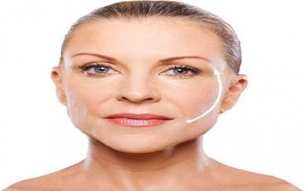 Dubai Silhouette Facelift: Achieve a Younger You Without Surgery