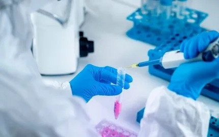 Pharmaceutical Analytical Testing Outsourcing Market Outlook Report 2024-2032