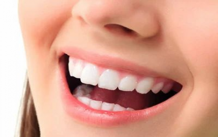Smile Makeovers: Transform Your Look with Cosmetic Dentistry in Dubai