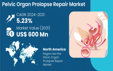 Pelvic Organ Prolapse Repair Market Growth, Trends, Size, Share, Demand And Top Growing Companies 2031