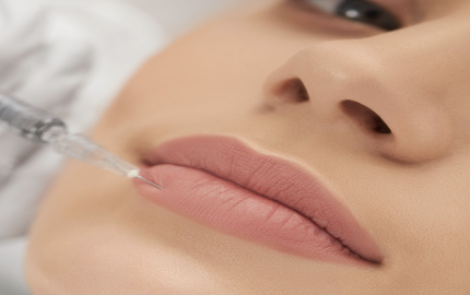 Radiesse Fillers Injections In Dubai: What You Should Know Before Taking Them