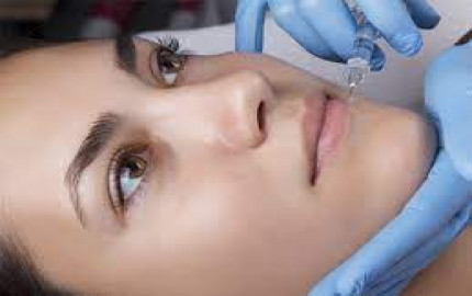 Enhancing Beauty with Radiesse Fillers: Your Ultimate Guide