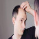 Follicular Finesse: Mastering FUE Hair Transplantation in Dubai