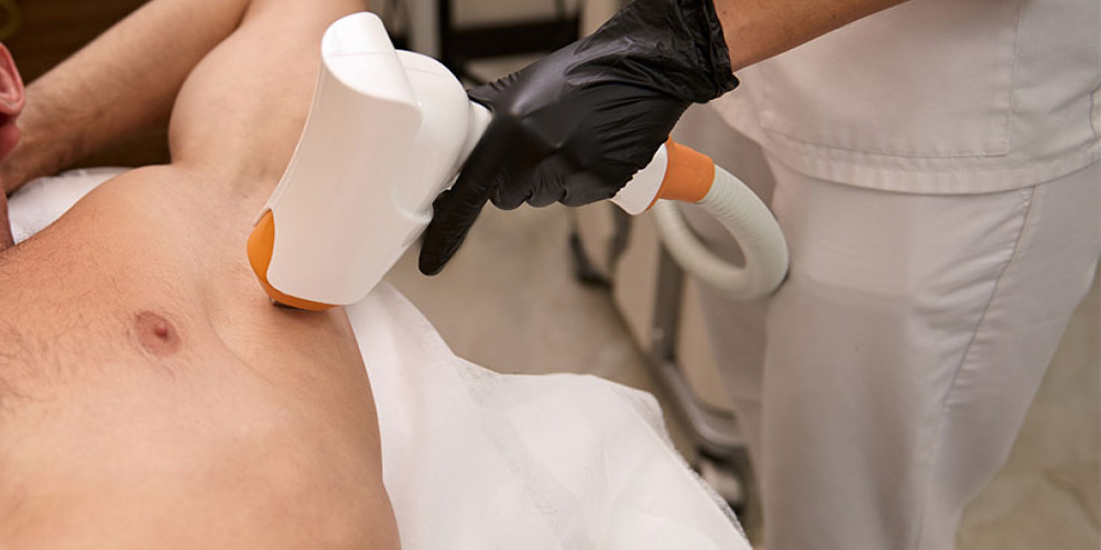 Can Chest Laser Hair Removal Help Prevent Ingrown Hairs?
