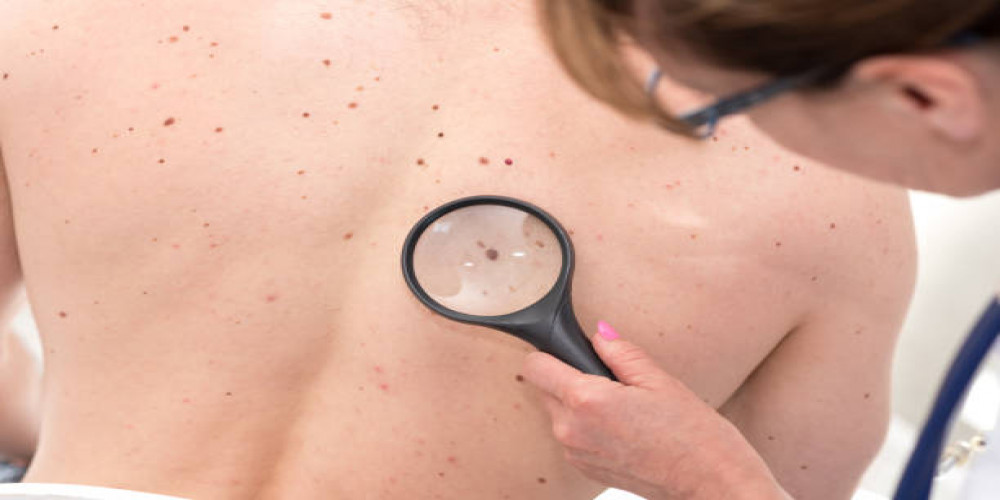 Illuminate Your Skin Journey: Dermoscopy in Riyadh