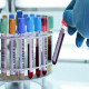 Unveiling Genetic Secrets: DNA Testing Options in Dubai